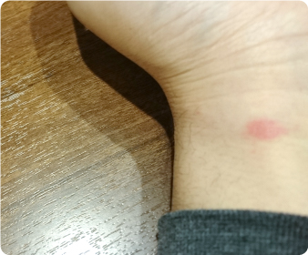 天日干しで死滅しないダニ退治